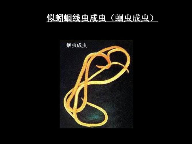 揭秘古方减肥胶囊：里面真的有蛔虫吗？(1)