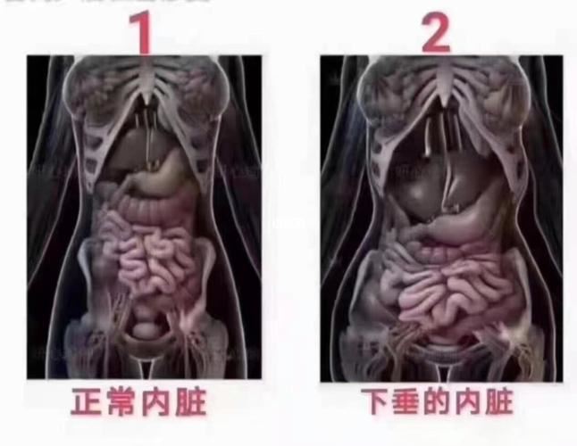 减内脏脂肪的中药配方：中医药减肥的有效策略(2)