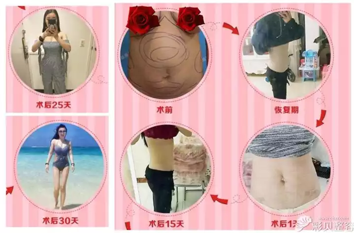 如何实现42岁女人的健康减肥？——成功案例分享(1)