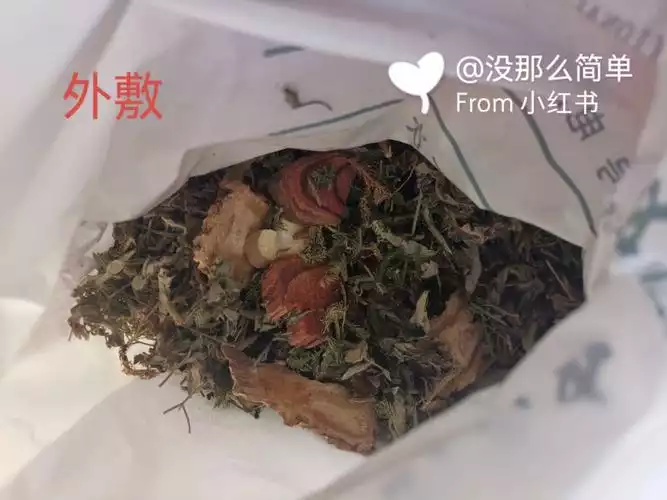 外敷减肥中药包和内服中药有冲突吗？——解析中药减肥的正确方法(1)